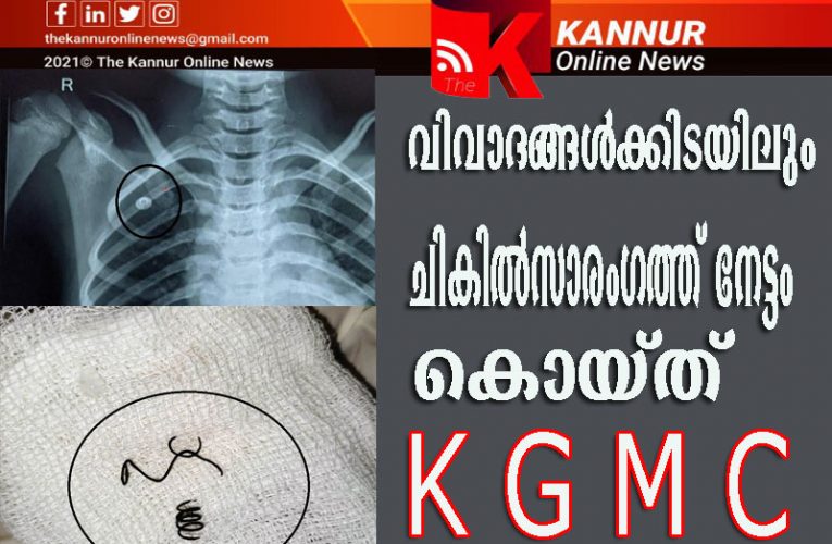 ശ്വാസകോശത്തില്‍ കുടുങ്ങിയ ലോഹനിര്‍മ്മിത സ്പ്രിംഗ് പുറത്തെടുത്തു: 11 വയസുകാരന് കണ്ണൂര്‍ ഗവ.മെഡിക്കല്‍ കോളേജ് ആശുപത്രിയില്‍ പുതുജന്മം