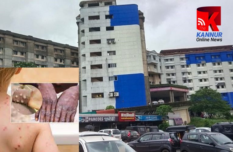 വാനരവസൂരി-മെഡിക്കല്‍ സൂപ്രണ്ട് ഡോ.കെ.സുദീപിന്റെ നേതൃത്വത്തില്‍ പ്രത്യേക മെഡിക്കല്‍ ബോര്‍ഡ് രൂപീകരിച്ചു-