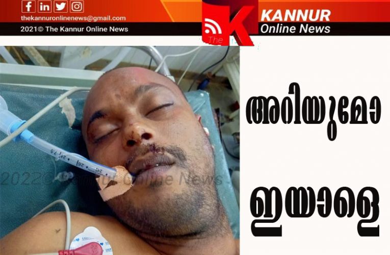 സൈക്കിളില്‍ നിന്ന് വീണ് ഗുരുതരനിലയില്‍