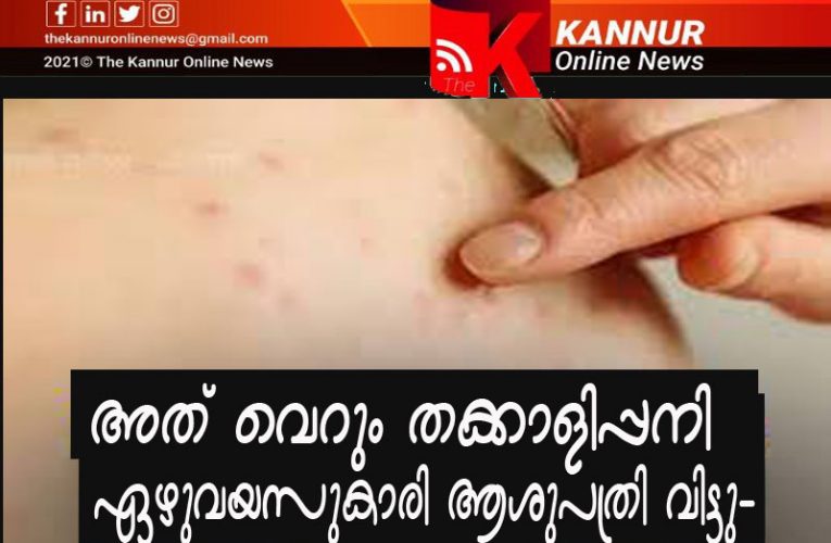 വെറും തക്കാളിപ്പനി-ഏഴുവയസുകാരി ആശുപത്രി വിട്ടു-