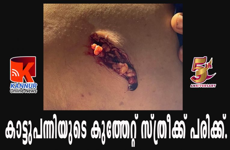 കാട്ടുപന്നിയുടെ കുത്തേറ്റ് സ്ത്രീക്ക് പരിക്ക്.