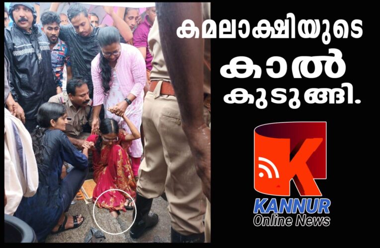 കാല്‍നടയാത്രക്കാരിയായ മധ്യവയസ്‌ക്കയുടെ കാല്‍പ്പാദം ഓവുചാലിന്റെ സ്‌ളാബില്‍ കുടുങ്ങി.