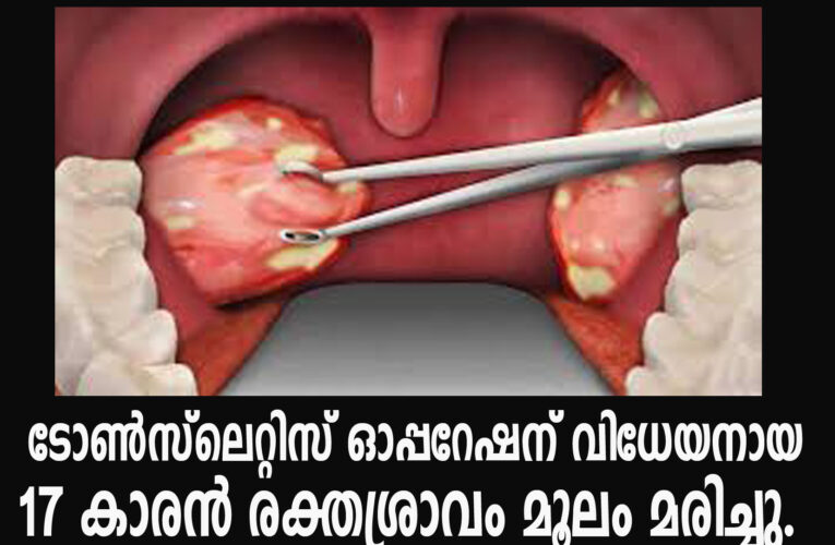 കണ്ണൂര്‍ പ്രിയ ഇ.എന്‍.ടി കെയര്‍ ക്ലിനിക്കില്‍ ശസ്ത്രക്രിയക്ക് വിധേയനായ 17 കാരന്‍ മരിച്ചു.