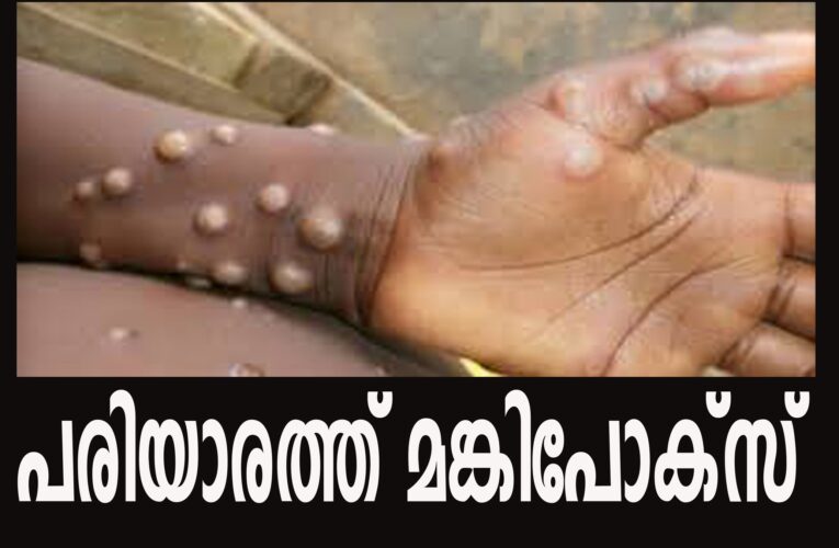 പരിയാരത്ത് രണ്ട് എംപോക്‌സ് രോഗികള്‍-രണ്ടുപേരും എത്തിയത് വിദേശത്തുനിന്ന്.