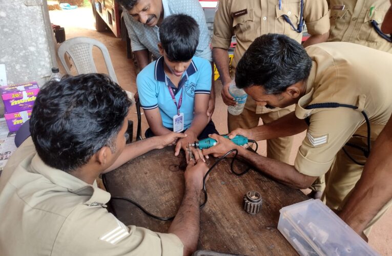 വിരലില്‍ കുടുങ്ങിയ സ്റ്റീല്‍മോതിരം അഗ്നിരക്ഷസേന മുറിച്ചുനീക്കി