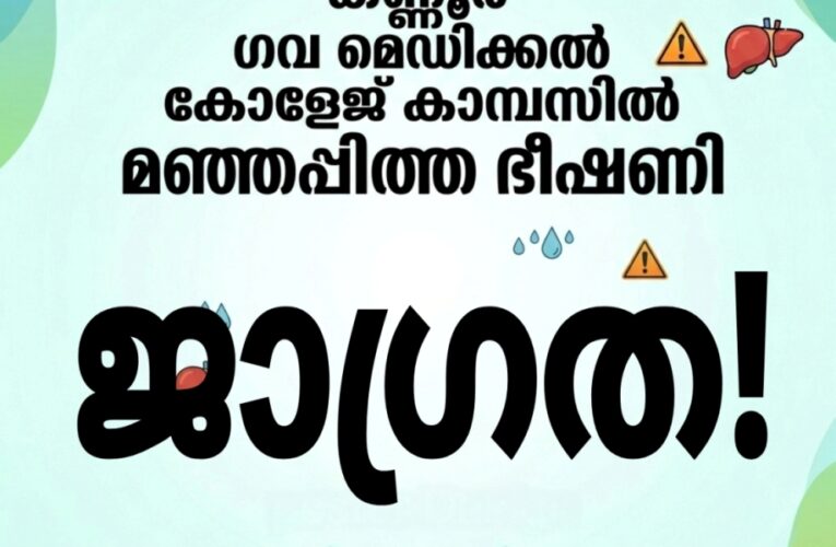 കണ്ണൂര്‍ ഗവ.മെഡിക്കല്‍ കോളേജ് കാമ്പസില്‍ മഞ്ഞപ്പിത്തരോഗം പടരുന്നു(വൈറല്‍ ഹെപറ്റെറ്റിസ് എ).